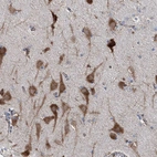 Immunohistochemical staining of human cerebral cortex shows strong cytoplasmic positivity in neurons.