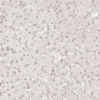 Immunohistochemical staining of human liver shows low expression as expected.