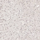 Immunohistochemical staining of human liver shows low expression as expected.