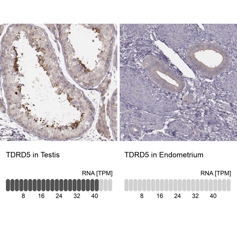 Anti-TDRD5 Antibody