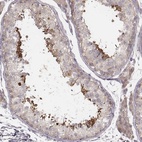 Anti-TDRD5 Antibody