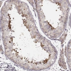 Immunohistochemical staining of human testis shows high expression.