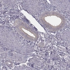 Immunohistochemical staining of human endometrium shows low expression as expected.