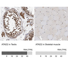 Anti-ATAD2 Antibody