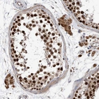 Immunohistochemical staining of human Testis shows strong nuclear positivity in cells in seminiferous ducts.