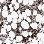 Immunohistochemical staining of human Bone marrow shows strong nuclear positivity in hematopoietic cells.
