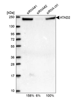 Western blot analysis in U2OS cells transfected with control siRNA, target specific siRNA probe #1 and #2, using Anti-ATAD2 antibody. Remaining relative intensity is presented.
