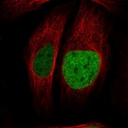 Anti-ATAD2 Antibody