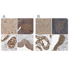 Anti-CCT8 Antibody