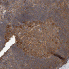 Immunohistochemical staining of human lymph node shows moderate cytoplasmic positivity in germinal center cells.