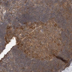 Immunohistochemical staining of human lymph node shows moderate cytoplasmic positivity in germinal center cells.