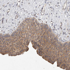 Immunohistochemical staining of human urinary bladder shows moderate cytoplasmic positivity in urothelial cells.