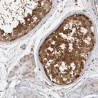 Immunohistochemical staining of human testis shows strong cytoplasmic positivity in cells in seminiferous ducts.