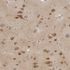 Immunohistochemical staining of human cerebral cortex shows strong cytoplasmic positivity in neurons.