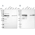 Western blot analysis using Anti-CCT8 antibody HPA029426 (A) shows similar pattern to independent antibody HPA018520 (B).