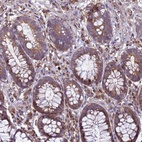 Anti-RNF215 Antibody