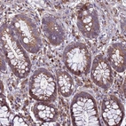 Anti-RNF215 Antibody