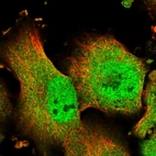 Immunofluorescent staining of human cell line U-251 MG shows localization to nucleoplasm & cytosol.