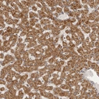 Anti-SEMA3A Antibody