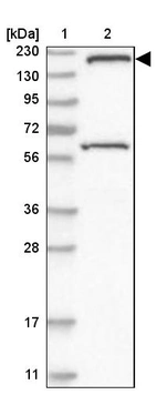 Lane 1: Marker [kDa] 230, 130, 95, 72, 56, 36, 28, 17, 11_br/_Lane 2: Human cell line RT-4