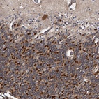 Anti-KCND3 Antibody