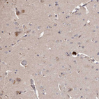 Immunohistochemical staining of human cerebral cortex shows moderate cytoplasmic positivity in neuronal cells.