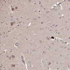 Immunohistochemical staining of human cerebral cortex shows moderate cytoplasmic positivity in neuronal cells.