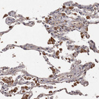 Anti-BRAT1 Antibody