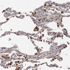 Immunohistochemical staining of human Lung shows moderate cytoplasmic positivity in macrophages.