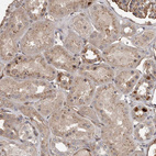 Immunohistochemical staining of human Kidney shows weak cytoplasmic positivity in cells in tubules.