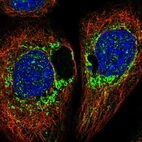 Immunofluorescent staining of human cell line A-431 shows localization to mitochondria.