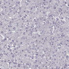 Immunohistochemical staining of human liver shows no positivity in hepatocytes as expected.