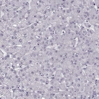 Immunohistochemical staining of human liver shows no positivity in hepatocytes as expected.