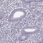 Immunohistochemical staining of human endometrium shows no positivity in glandular cells as expected.