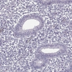 Immunohistochemical staining of human endometrium shows no positivity in glandular cells as expected.