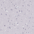 Immunohistochemical staining of human cerebral cortex shows no positivity in neurons as expected.