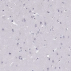 Immunohistochemical staining of human cerebral cortex shows no positivity in neurons as expected.