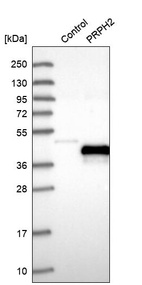 Western blot analysis in control (vector only transfected HEK293T lysate) and PRPH2 over-expression lysate (Co-expressed with a C-terminal myc-DDK tag (~3.1 kDa) in mammalian HEK293T cells, LY400122).