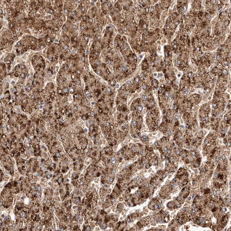 Anti-LRRC25 Antibody