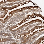 Immunohistochemical staining of human duodenum shows strong cytoplasmic positivity in glandular cells.