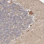 Immunohistochemical staining of human cerebellum shows moderate cytoplasmic positivity in Purkinje cells.