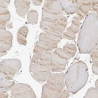 Immunohistochemical staining of human skeletal muscle shows very weak positivity in myocytes.