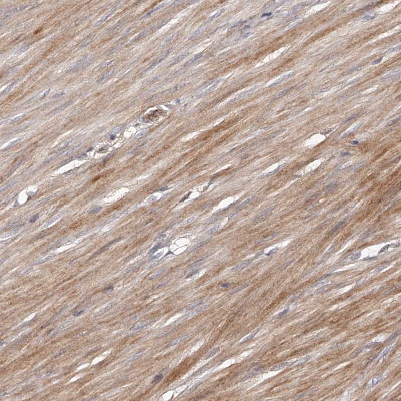 Anti-URGCP Antibody
