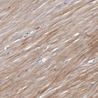 Anti-URGCP Antibody