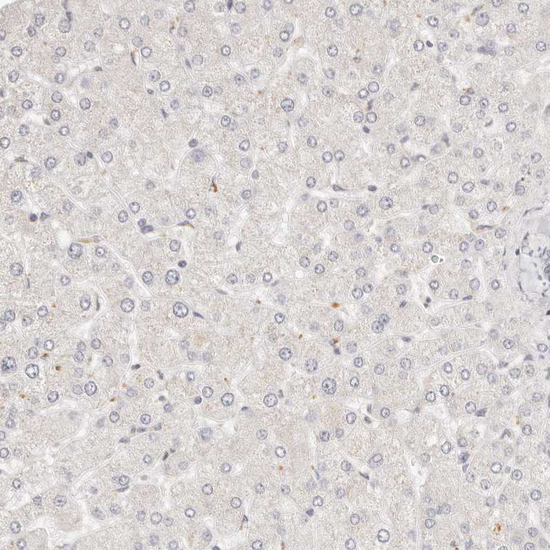 Anti-GGPS1 Antibody