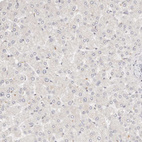 Anti-GGPS1 Antibody