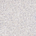 Anti-GGPS1 Antibody