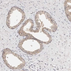 Immunohistochemical staining of human prostate shows moderate cytoplasmic positivity in glandular cells.