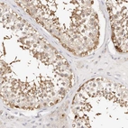 Immunohistochemical staining of human testis shows strong cytoplasmic positivity in cells in seminiferous ducts.