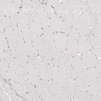 Immunohistochemical staining of human skeletal muscle shows no positivity in myocytes as expected.